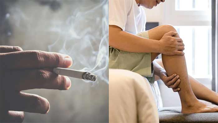 سبک زندگی و اثر آن بر سلامت استخوان